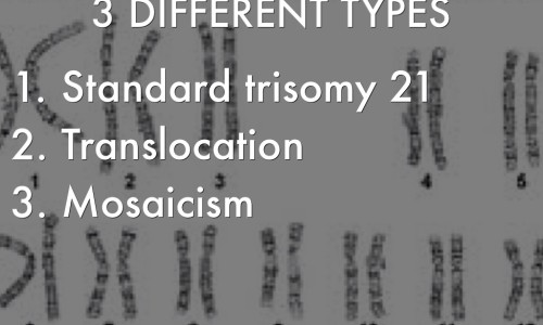 向日葵茎图片网 | 向日葵的图片高清大图,向日葵图片真实照片